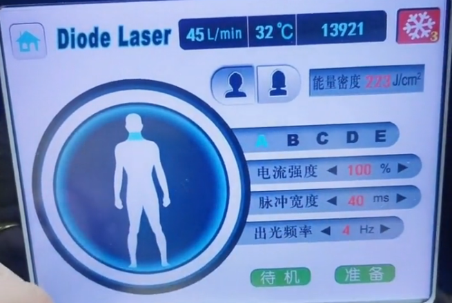 808脫毛儀怎么調(diào)節(jié)參數(shù)